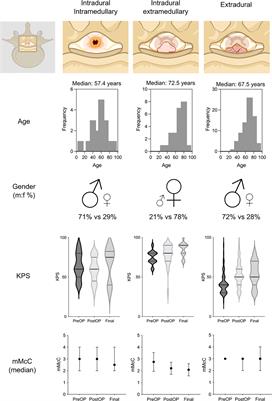 Spinal oncologic paraparesis: Analysis of neurological and surgical outcomes in patients with intramedullary, extramedullary, and extradural tumors